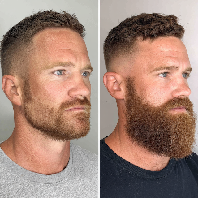 Fade beard combination showing seamless transition from beard to haircut